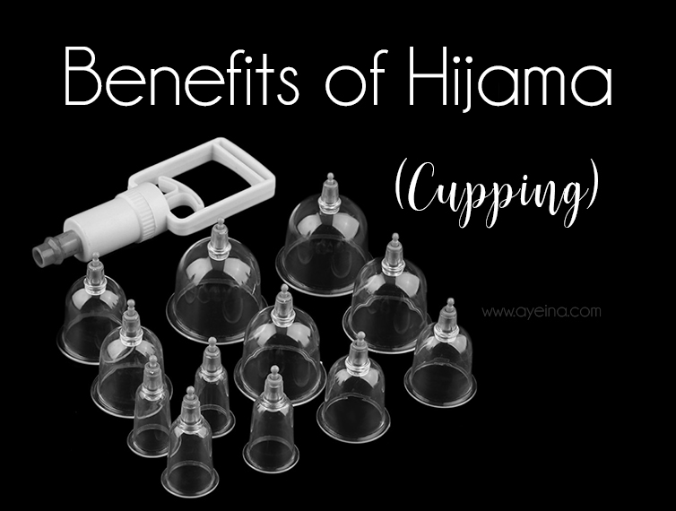 5 Reasons Why You Should Get Hijama [cupping] Done